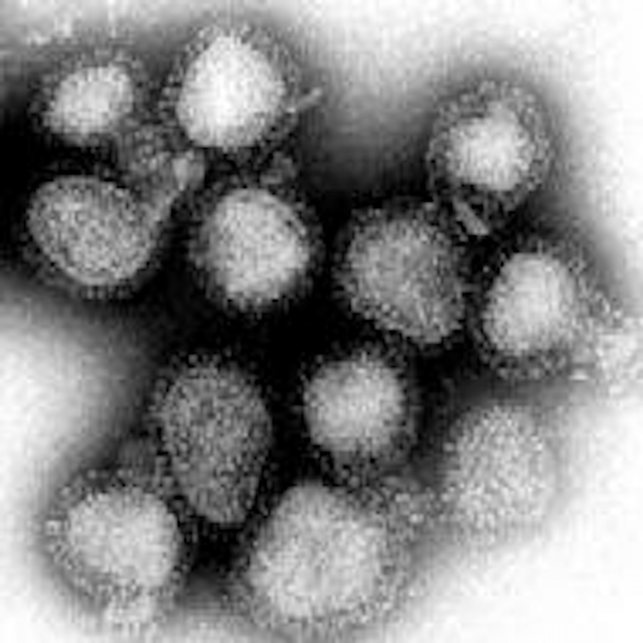 The influenza viruses that caused the Hong Kong flu (magnified approximately 100,000 times). Image credit: Wikimedia.org