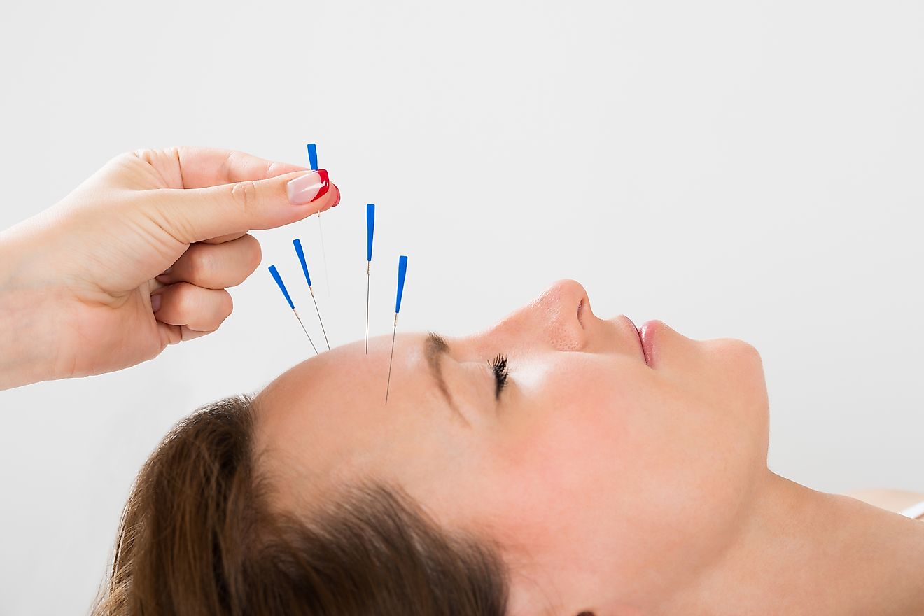 The origins of the practice of acupuncture can be traced back to at least 600 BCE. 