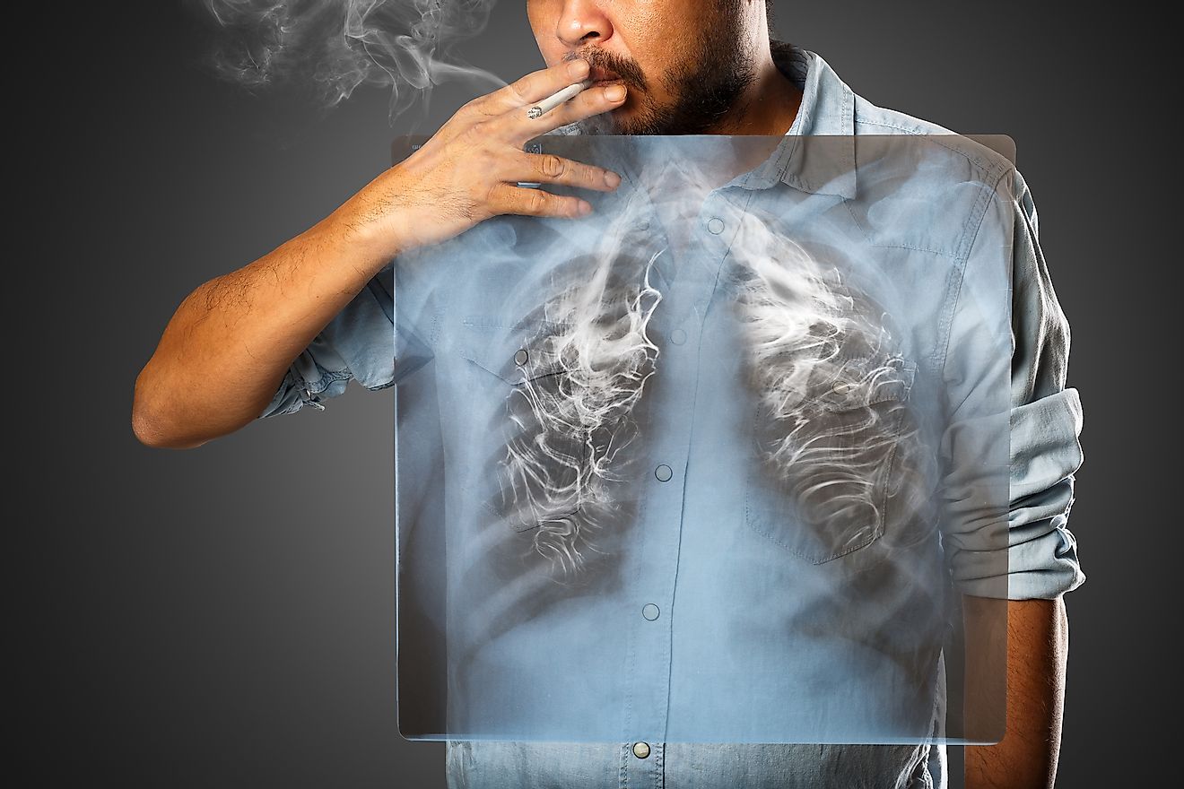Smoking is one of the leading causes of cancer, a disease with a low survival rate. Image credit: Krunja/Shutterstock.com