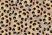 What is Trypophobia?