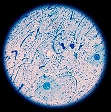 TB Infection Rates