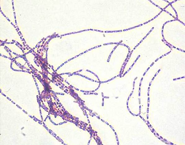 Anthrax Facts - Diseases of the World