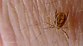 Tick, a species of Ixodidae. Royal National Park, NSW Australia, By John Tann from Sydney, Australia - Tick, https://creativecommons.org/licenses/by/2.0, https://commons.wikimedia.org/w/index.php?curid=38231255