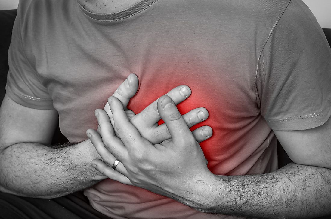 U.S. Cities with the Highest Rates of Heart Disease