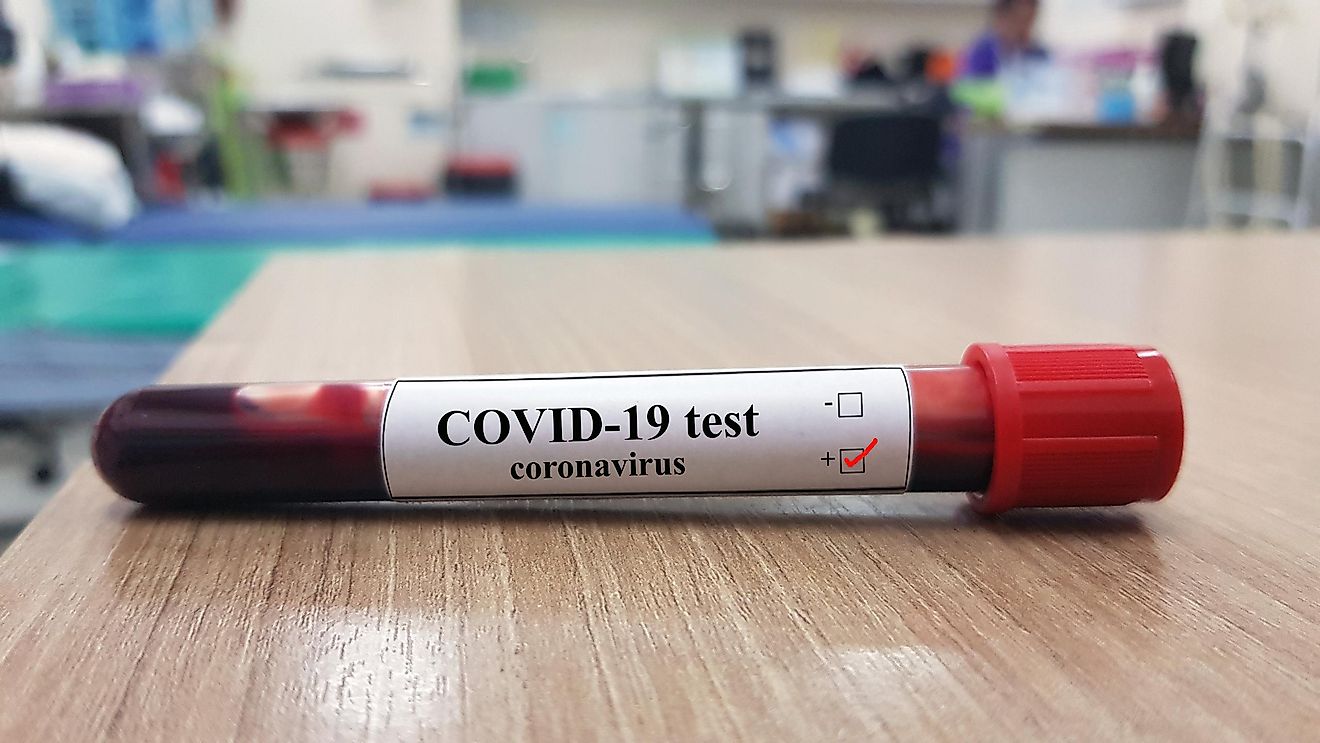 What Countries Have Been Most Affected By Covid-19 Thus Far?