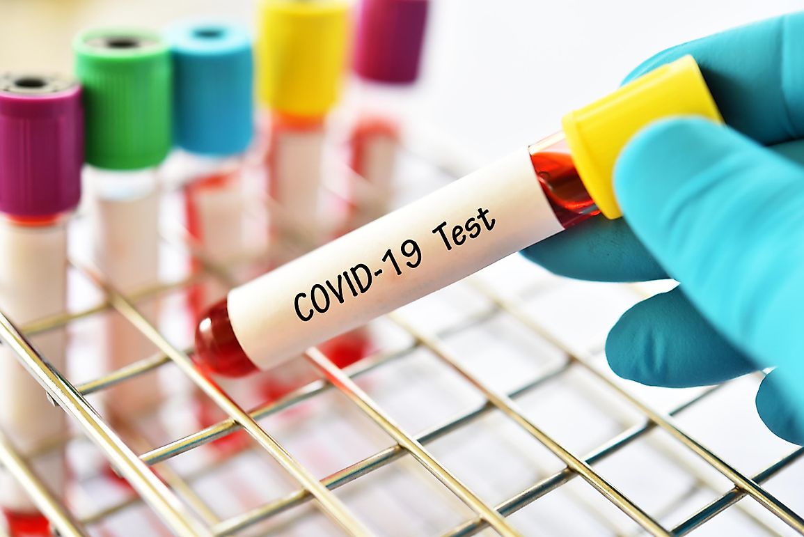 How To Test If You Have The Coronavirus - In 9 Steps