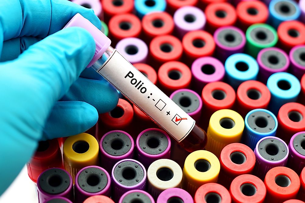 Polio Rates Over Time