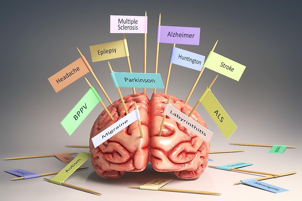 5 Most Common Genetic Disorders In The US