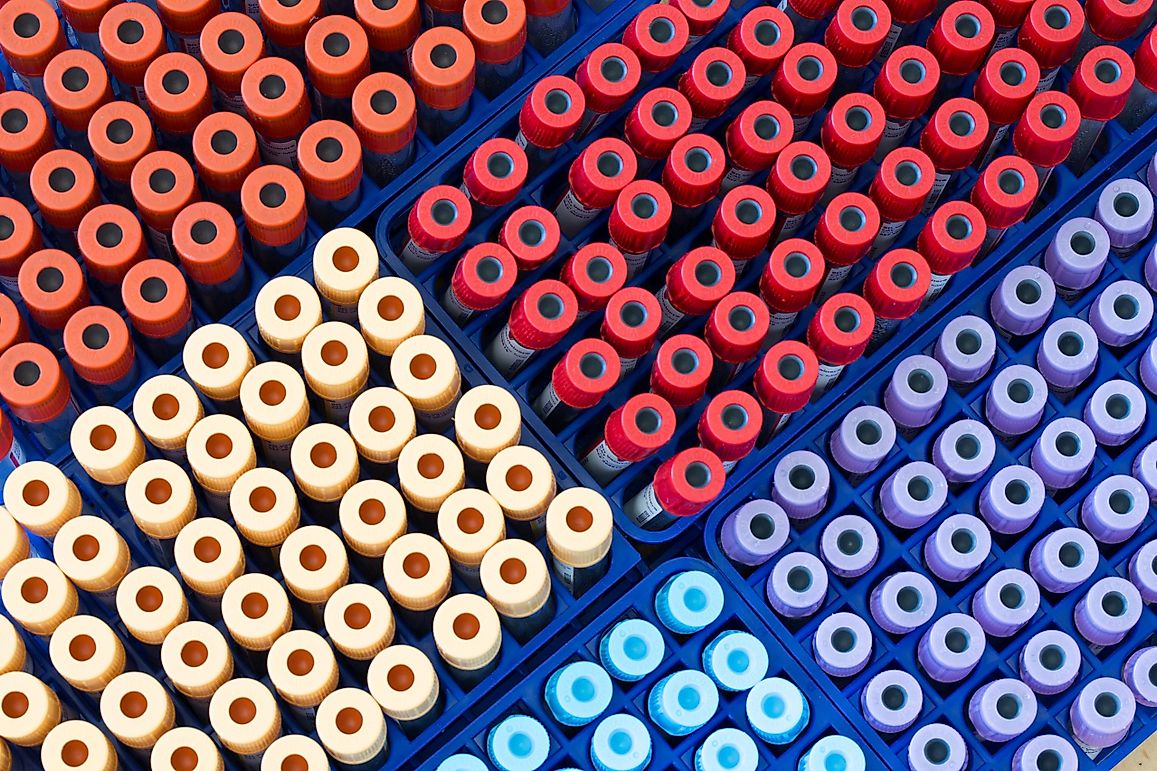 What Is Phlebotomy?