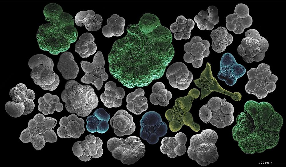 What Are Protozoa?