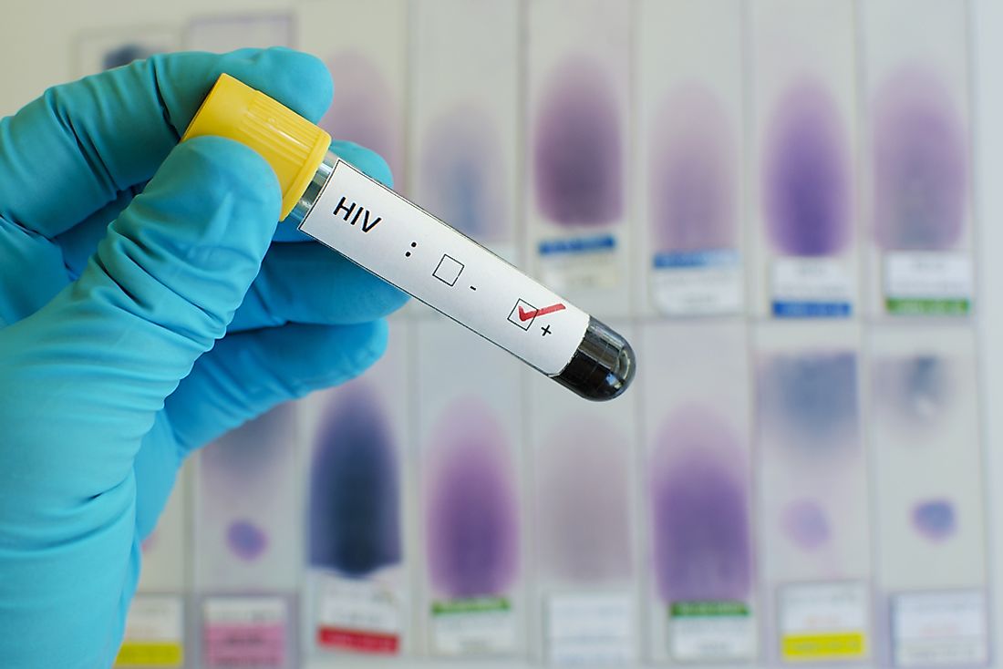 A blood test is the only way to confirm HIV infection. 