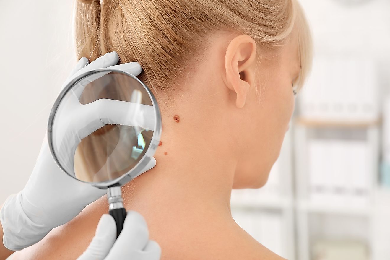 A doctor examining a female patient's skin for possible cancerous lesions. Image credit: Africa Studio/Shutterstock.com