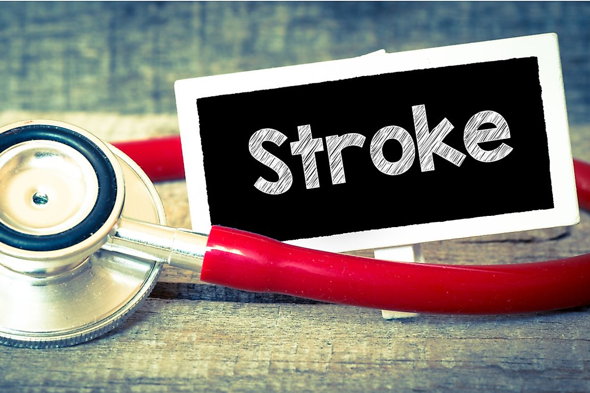 A 9-state region in the southern US is known as the stroke belt due to higher than average rates of stroke.