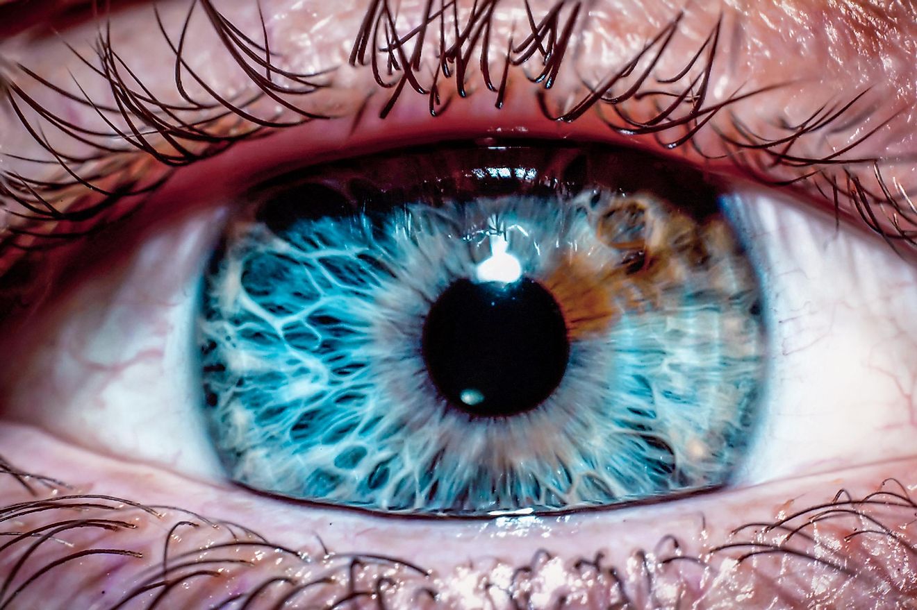 Human eye close-up. Heterochromia iridum.
