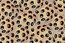 What is Trypophobia?