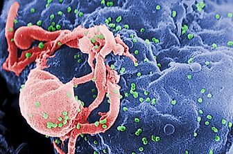 What Is The Difference Between HIV And AIDS?