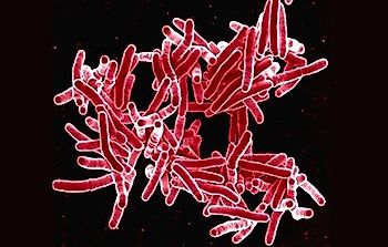What's The Deadliest Bacterial Disease?