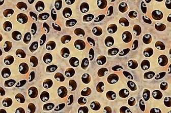What is Trypophobia?