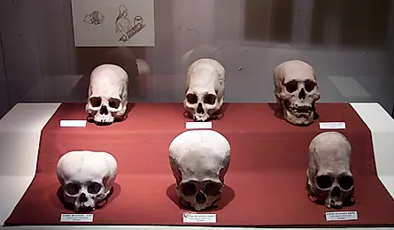 A set of Paracas culture skulls that show a range of different types of cranial modification. By Robrrb at English Wikipedia, CC BY-SA 3.0 (https://creativecommons.org/licenses/by-sa/3.0), Wikimedia Commons.