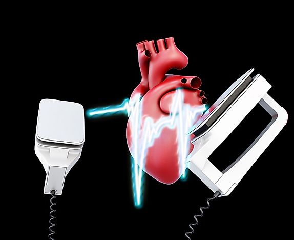 Countries With Highest Rates of Cardiovascular Disease Deaths