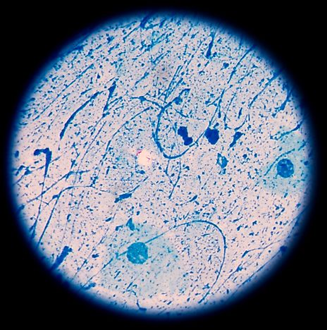 TB Infection Rates