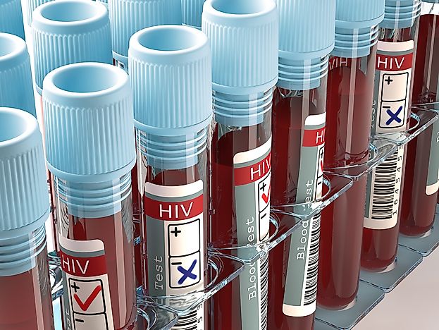 U.S. Cities By HIV Diagnoses