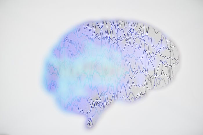 Epilepsy Facts: Diseases of the World