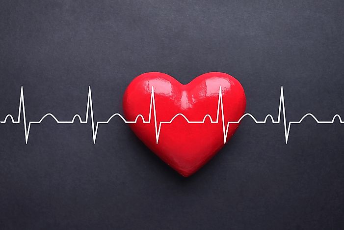 What is Tachycardia?