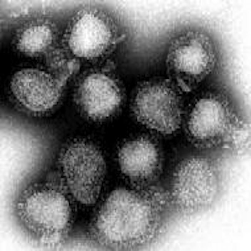 The influenza viruses that caused the Hong Kong flu (magnified approximately 100,000 times). Image credit: Wikimedia.org