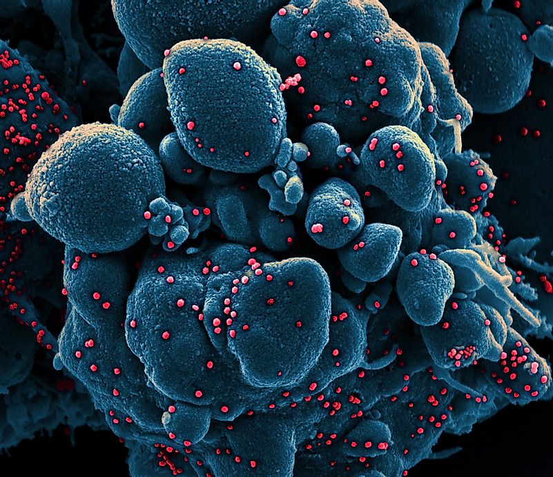 Vir Biotechnology's antibody treatment may soon start human trials. Image credit: www.statnews.com
