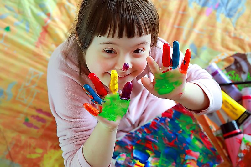 People that are born with Down syndrome suffer from a broad spectrum of cognitive difficulties. People that are born with Down syndrome suffer from a broad spectrum of cognitive difficulties.