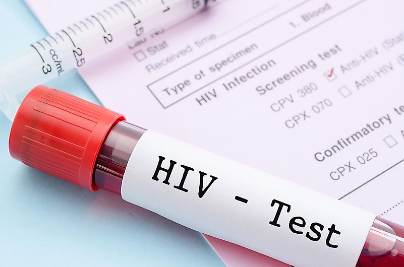 In 2007, another huge success happened, as a doctor Gerol Hütter, cured Timothy Ray Brown by healing him with bone marrow from a person that was HIV-immune. In 2007, another huge success happened, as a doctor Gerol Hütter, cured Timothy Ray Brown by healing him with bone marrow from a person that was HIV-immune.