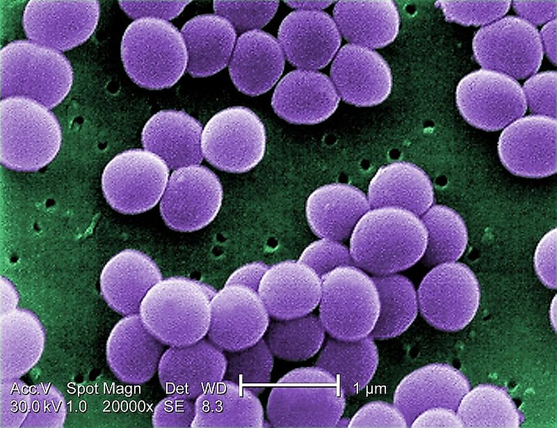 People with diabetes and cancer are susceptible to Staphylococcus aureus. Image credit: wikimedia.org