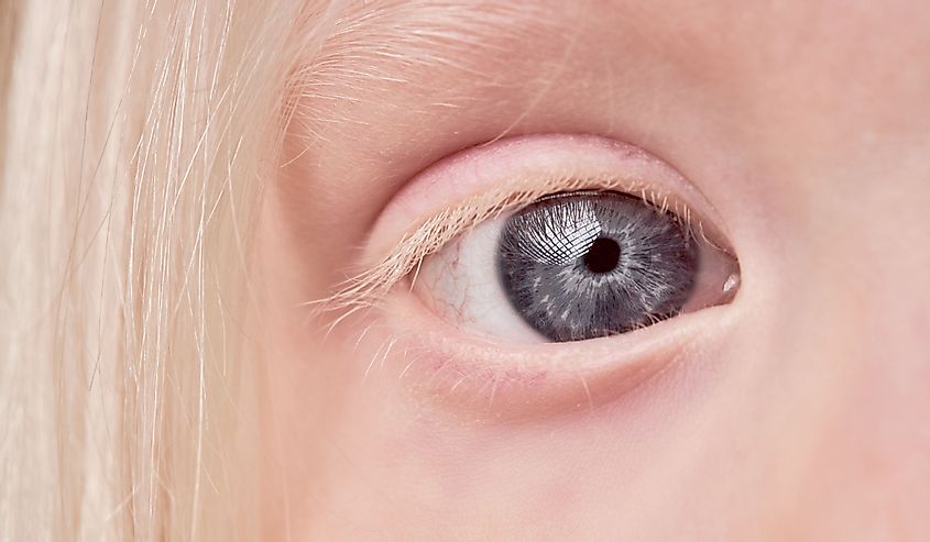 close-up mystic photo of albino child eye