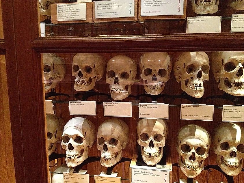Display inside the Mütter Museum.