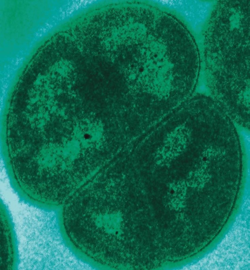 Transmission electron microgragh (TEM) of Deinococcus radiodurans