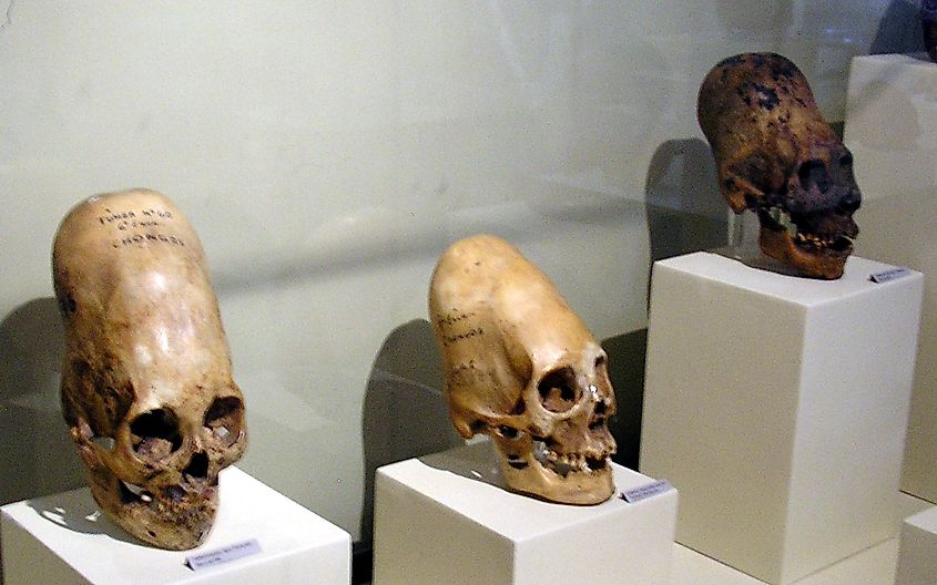 A set of Paracas culture skulls that show a range of different types of cranial modification.