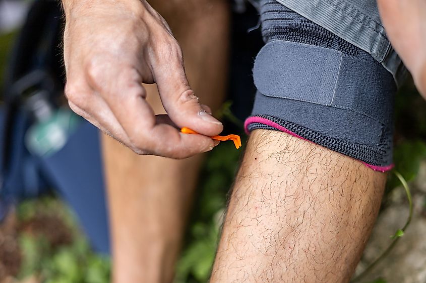 A person removing a tick with a pair of tweezers.