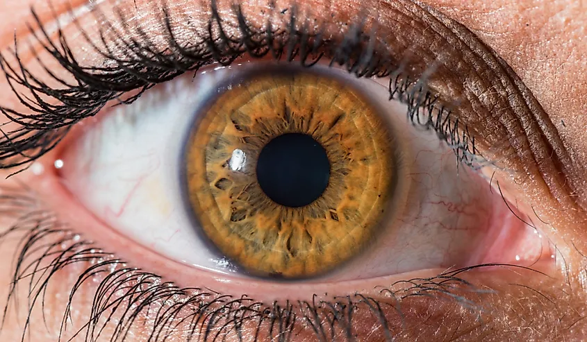 Hazel eye