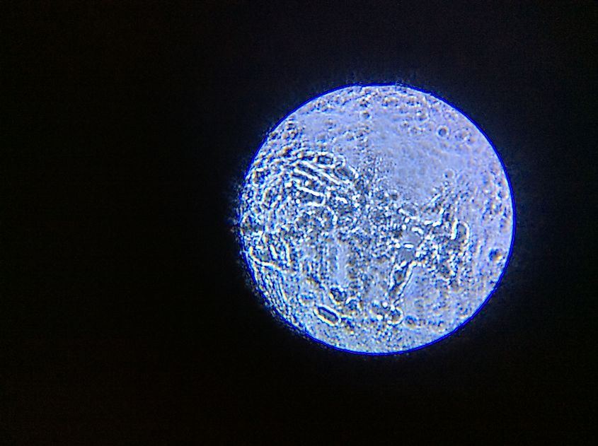 Microbe viewed under a microscope lens