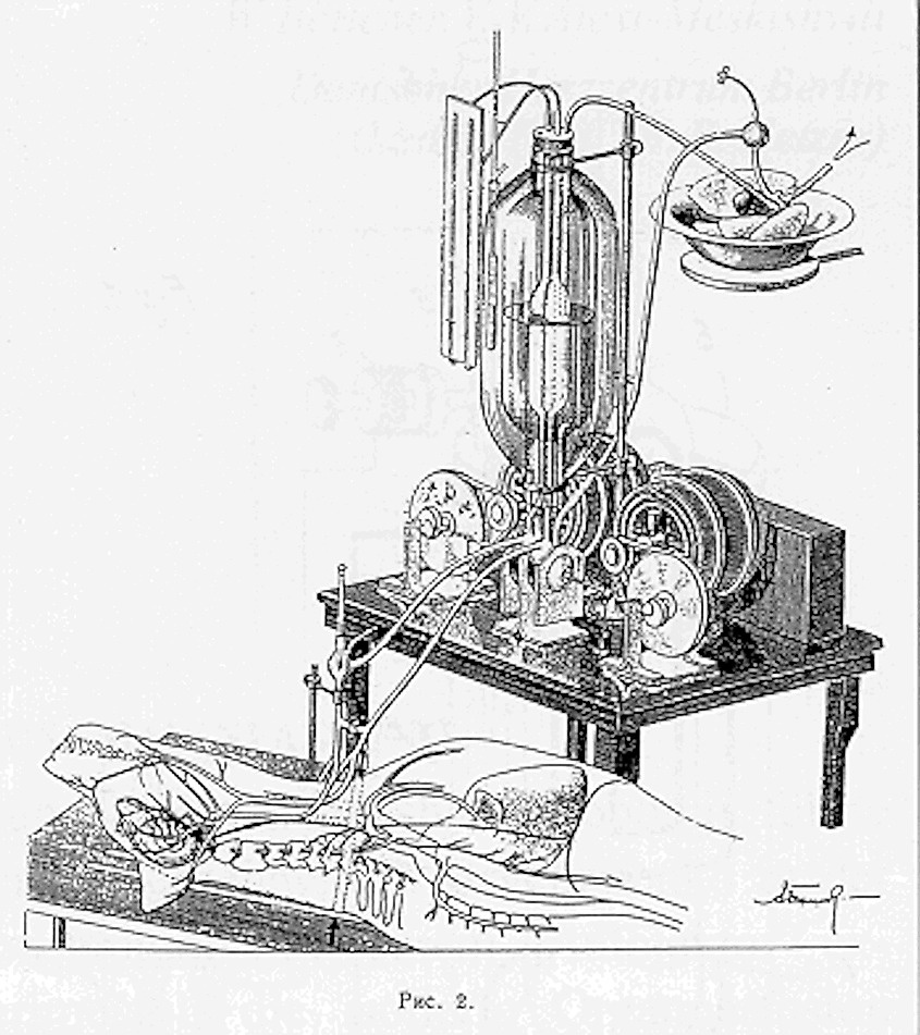A Soviet patent diagram showing the autojektor in use.