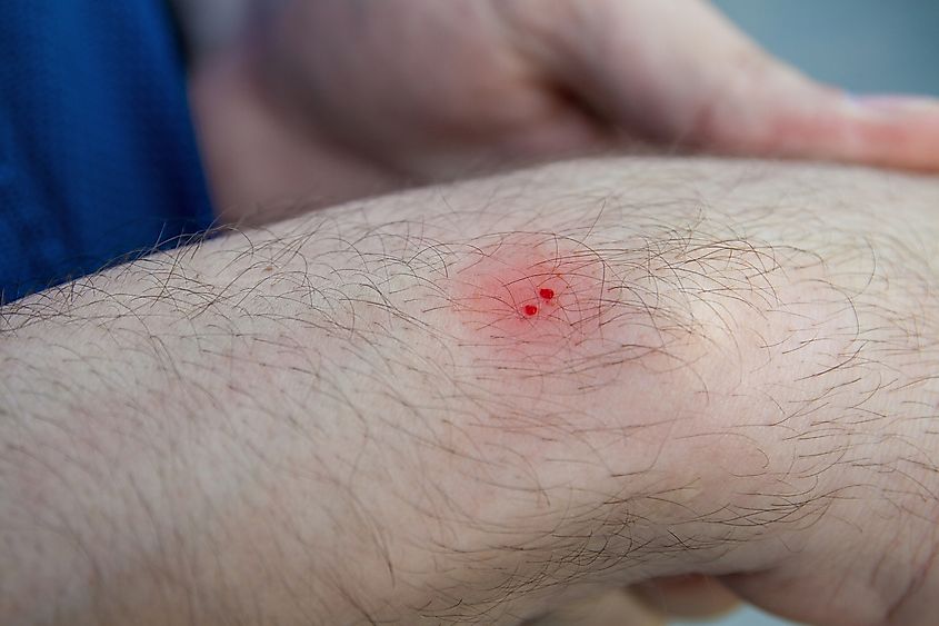 How Many Australians Die Due To Snakebites Each Year WorldAtlas