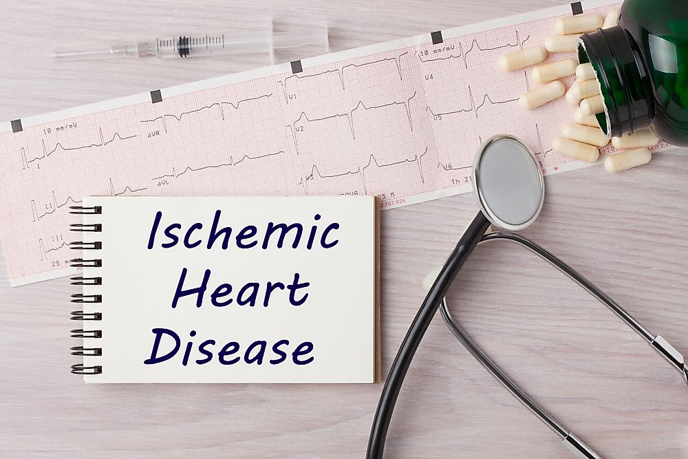 Ischemic heart disease is the leading cause of death for women worldwide.